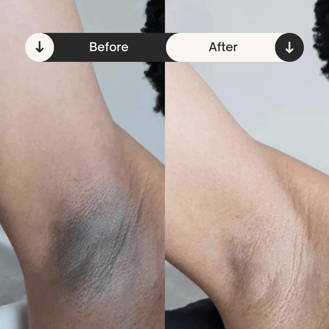 Avara Brightening Serum