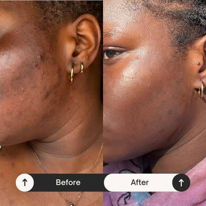2 Avara Brightening Serum + 4 Free Gifts